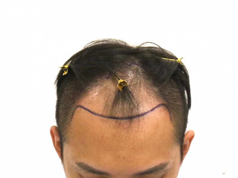 1000020094.jpg