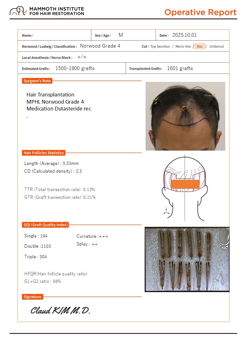 Busan Hair Transplantation Slit Method Mammoth Hair Restoration Center M-shaped Surgery Day Review