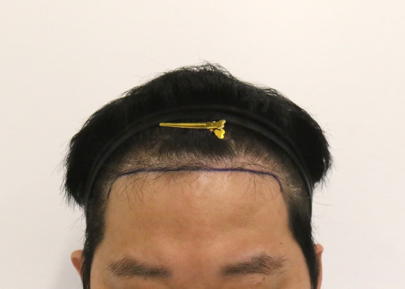1000001467.jpg