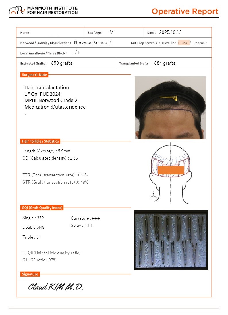 Slit Method for Mammoth Hairline in Busan