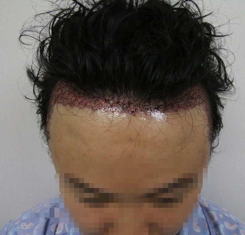 전면위 (후).jpg