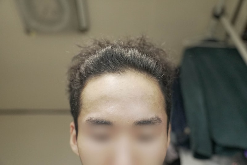 b-1.jpg