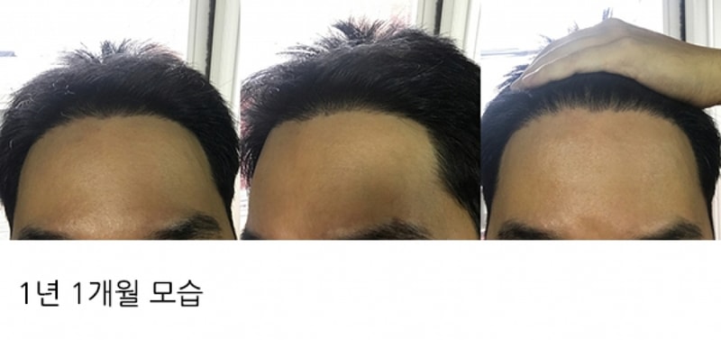 batch_????? 2017. 8. 8. ???? 6 40 28-side.jpg