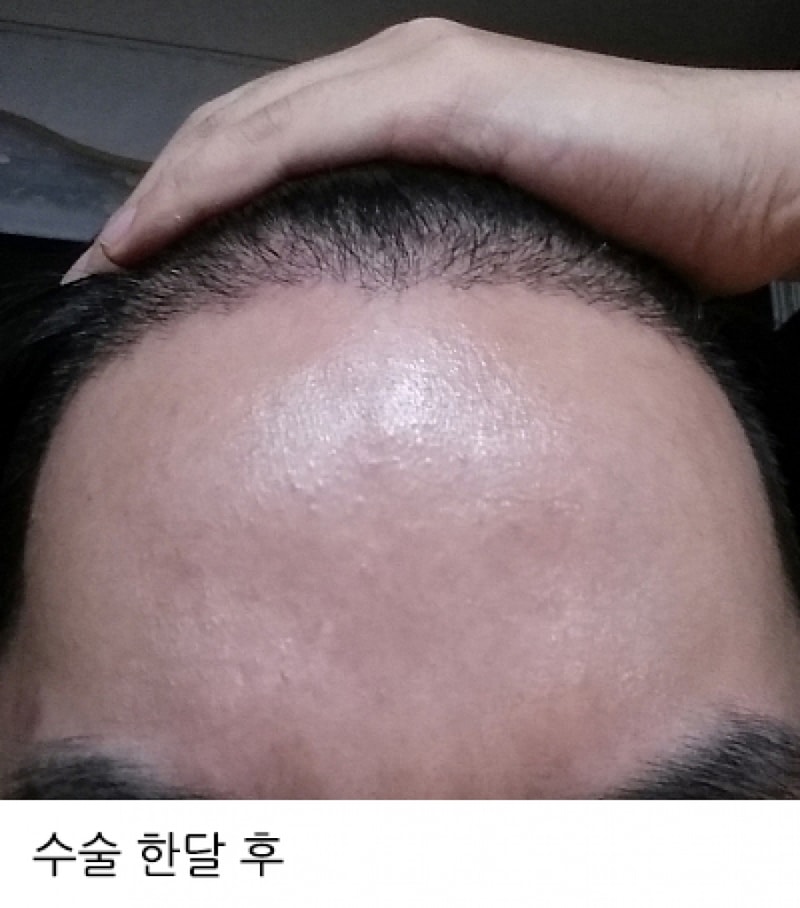 batch_IMG_20160805_214605.jpg