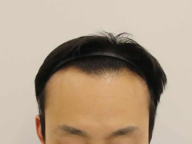 수술 전.jpg