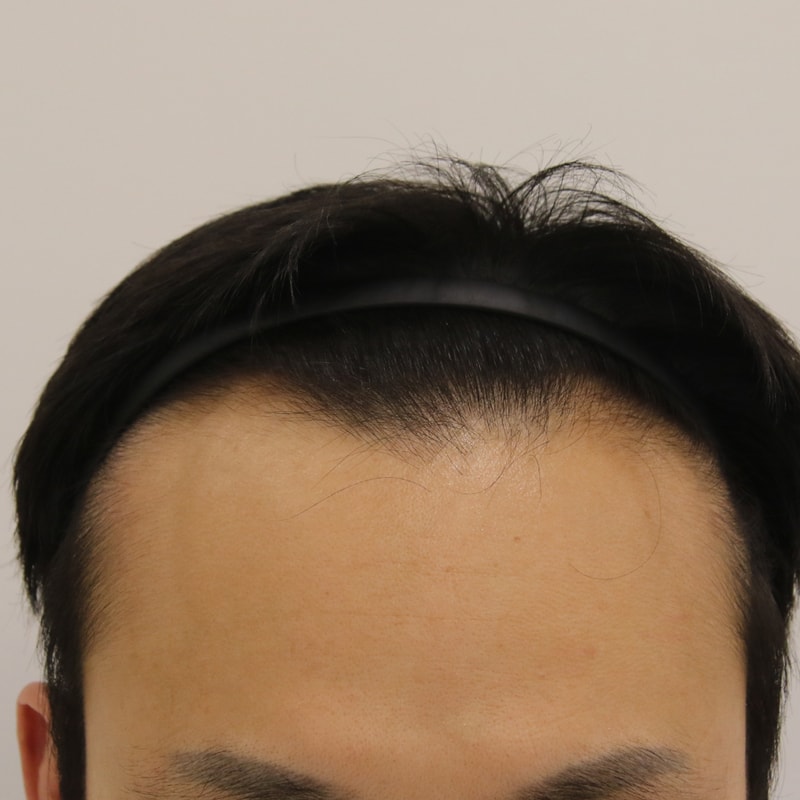 수술 전.jpg