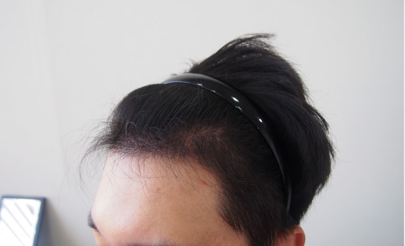 좌측면.PNG