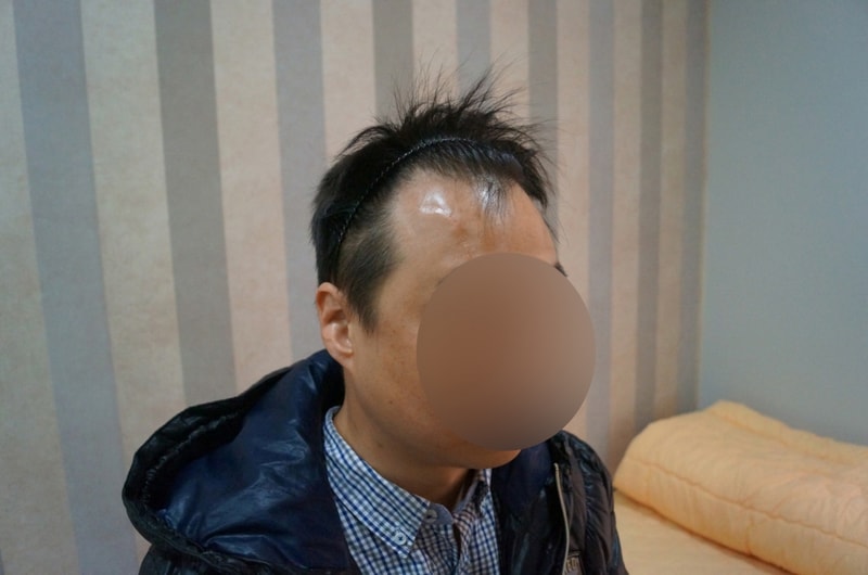 수술전 우측.jpg