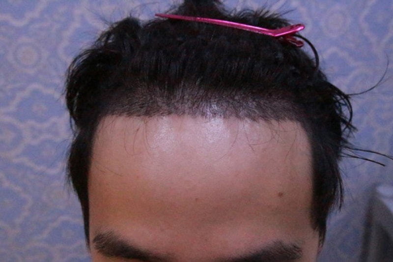 b후 (1).JPG