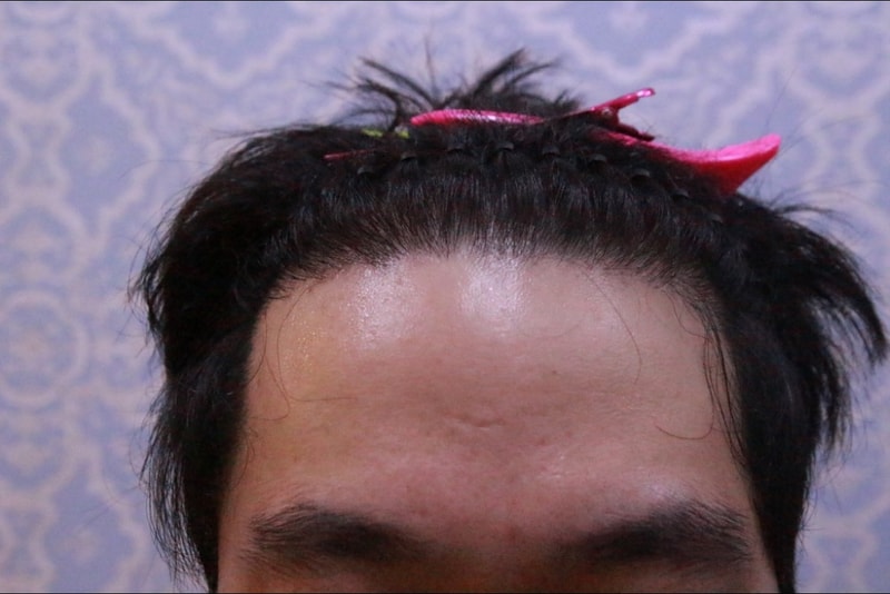 9개월 경과.JPG
