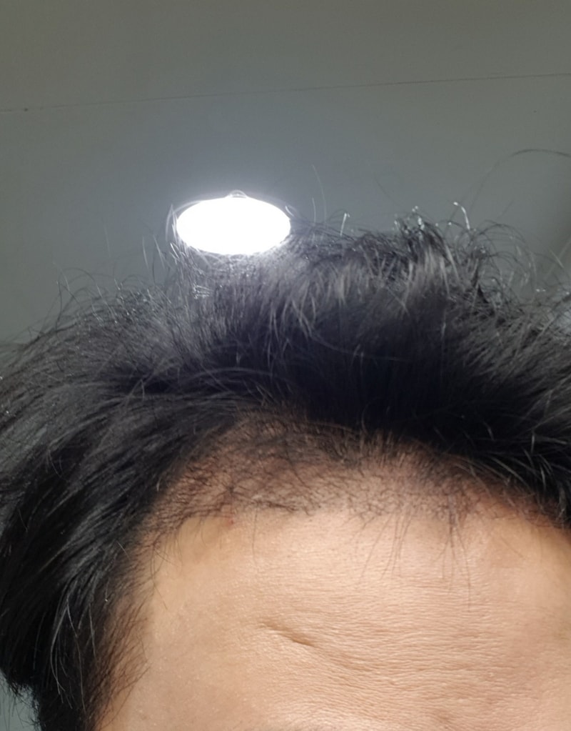 3개월차.jpg