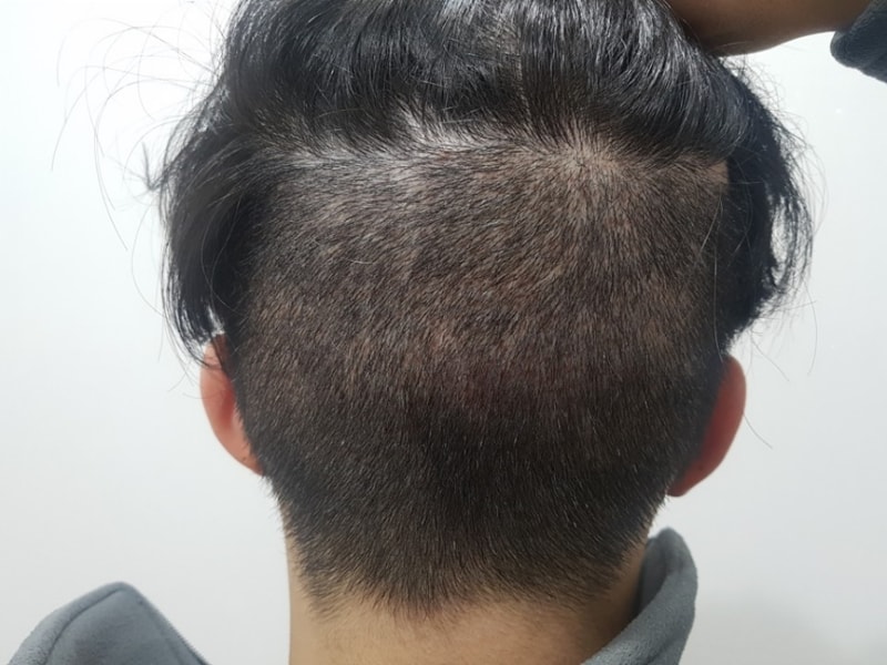 15일후 뒷모습.jpg
