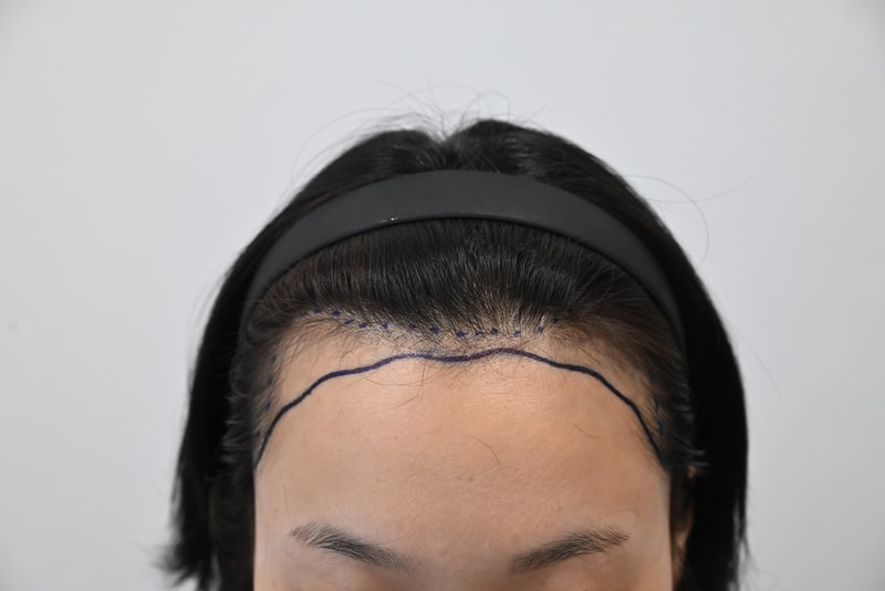 수술전1.jpg