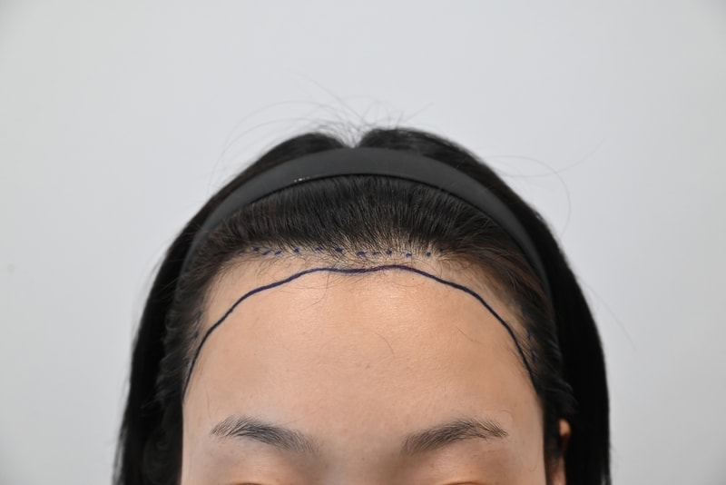 수술전2.jpg