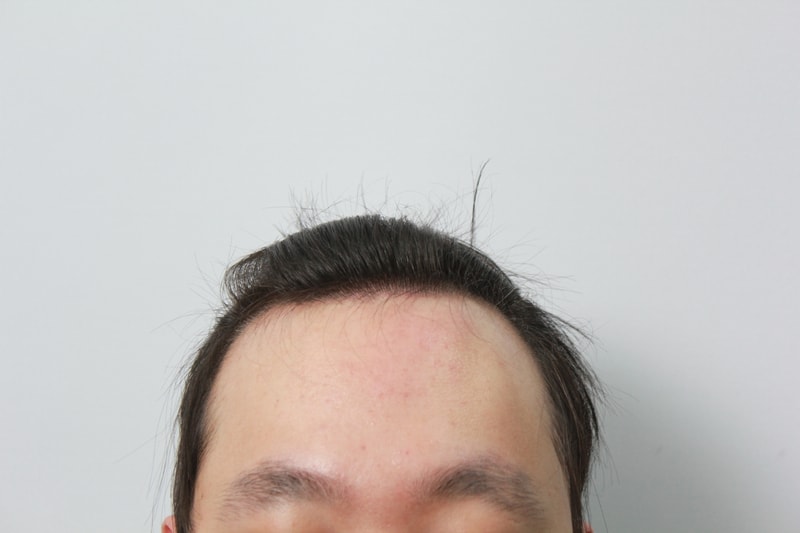 수술전 2.JPG