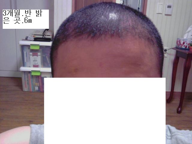 6m밝은곳 3개월반.JPG