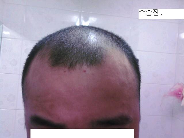 수술전 욕실.JPG