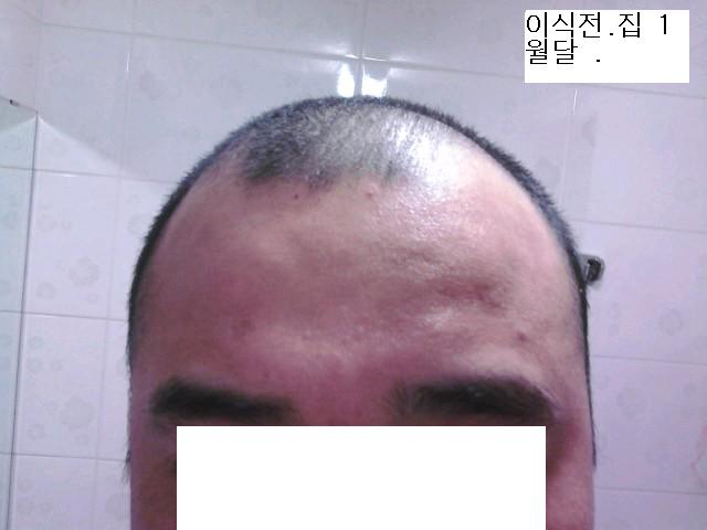 이식전 집.jpg