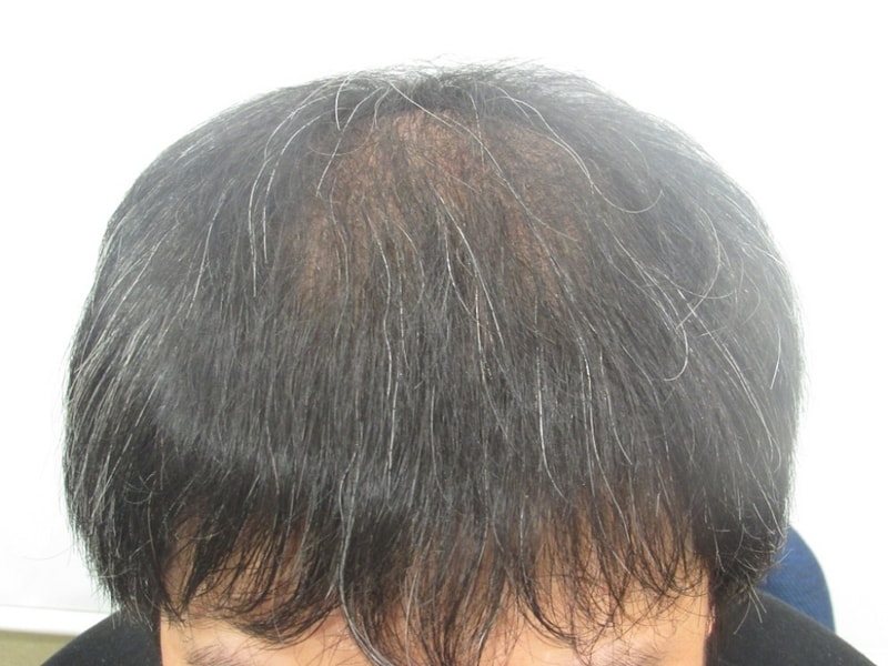 15.2.16 3mo.JPG