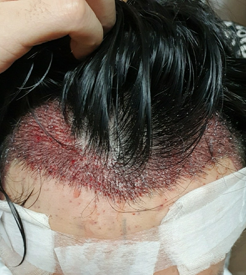 수술당일2.jpg