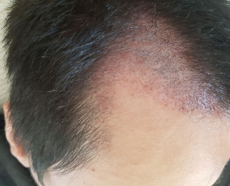 3개월후기 이제 암흑이 끝나가는 것인지,  요즘 살맛납니다