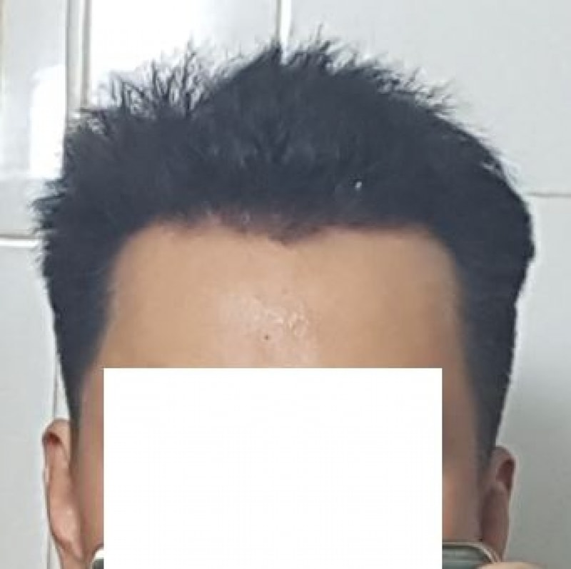 정면.JPG