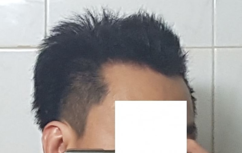 좌측.JPG
