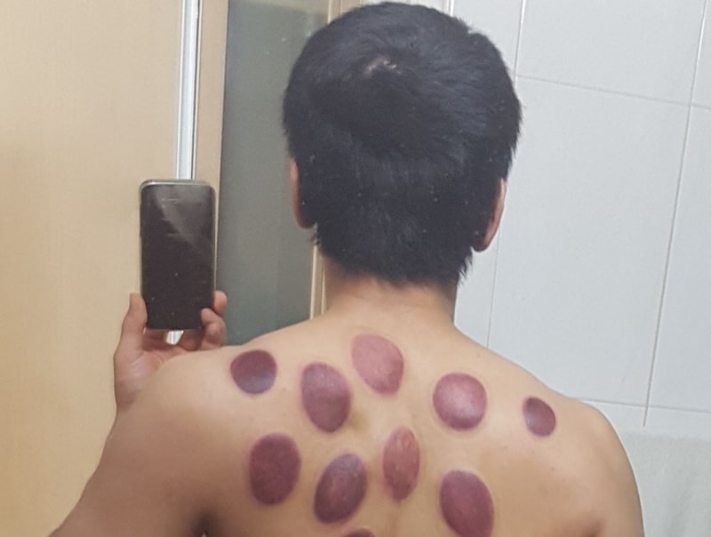 후두부.JPG