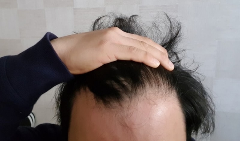 드디어 어제 이식을하였네요...