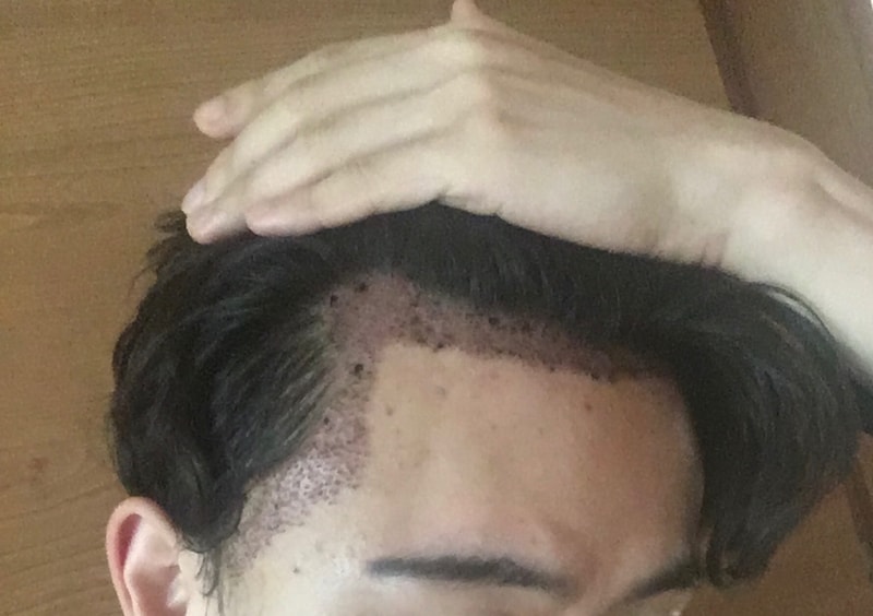 수술후 사진1.jpg