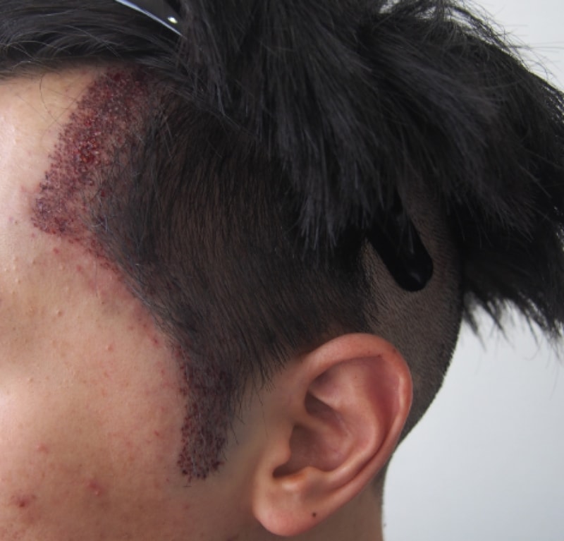수술후 캡쳐1.PNG