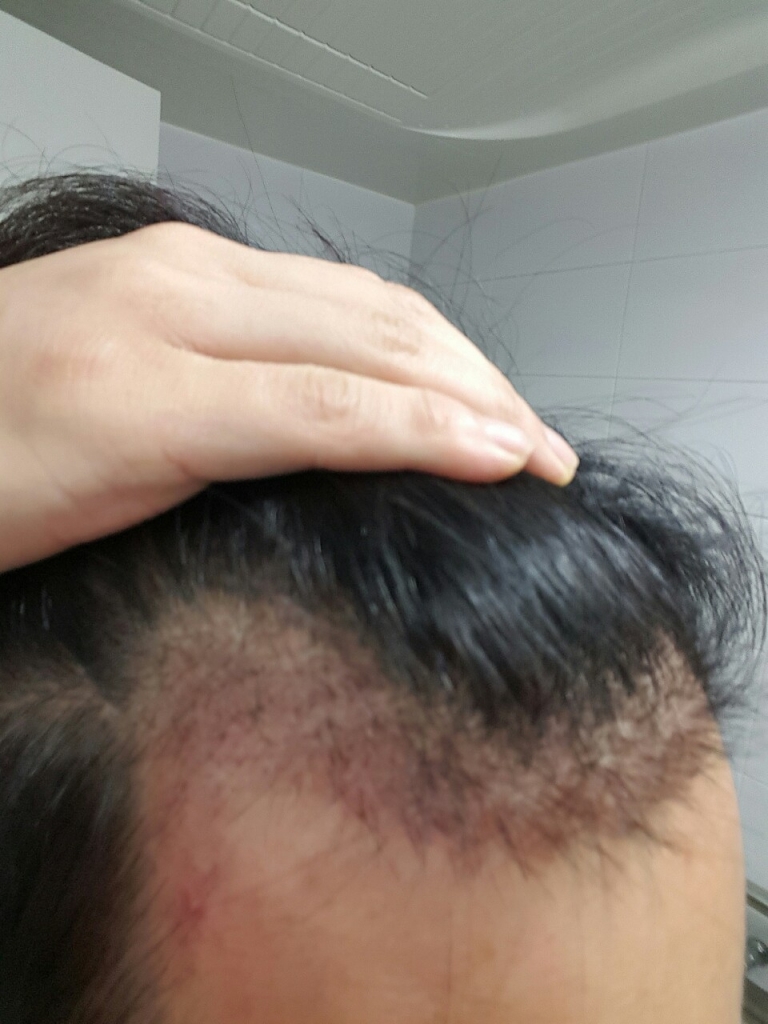 3주 오른쪽.jpg