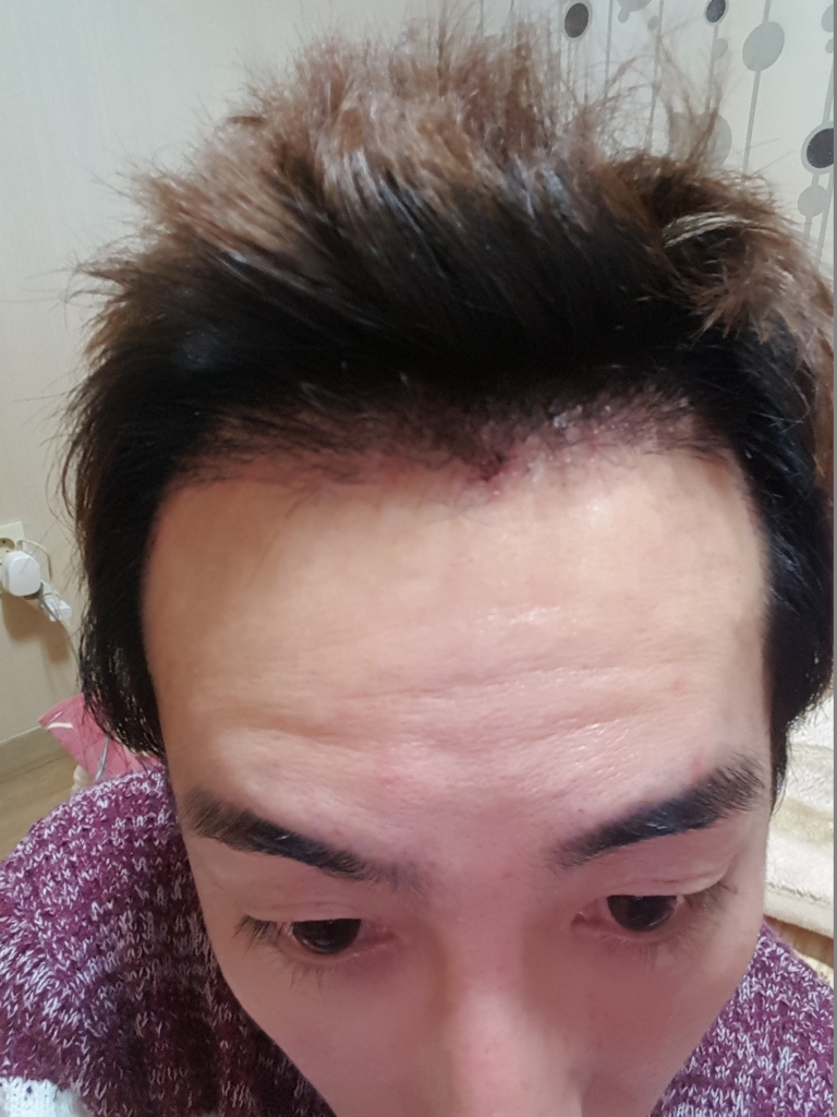 20170210_181354.jpg