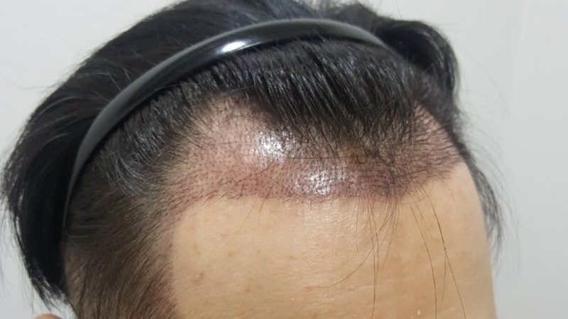 10일차 우측.jpg