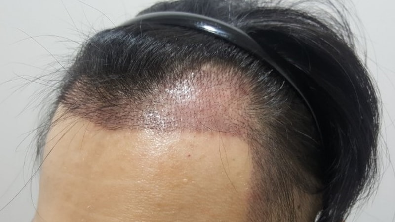 10일차 좌측.jpg