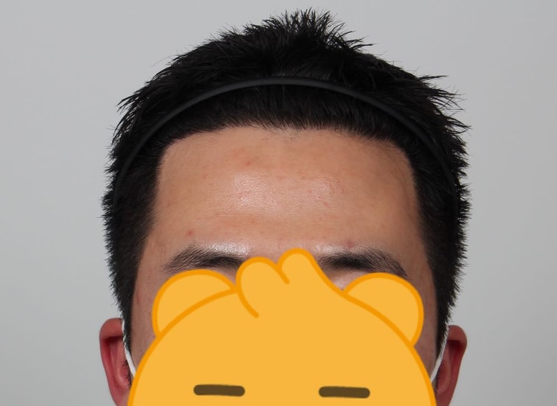 01.1년후.jpg