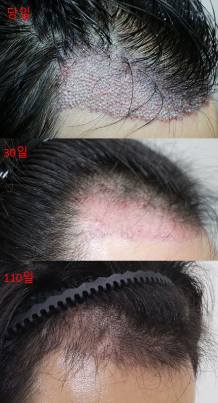 02.암흑기탈출과정.JPG