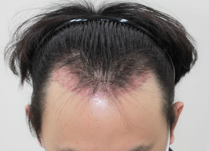 05.암흑기.JPG