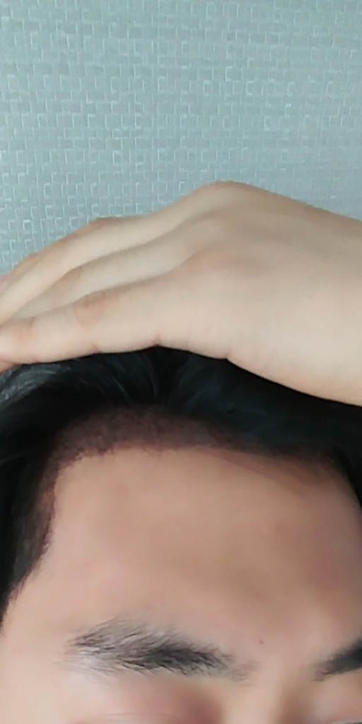 이마2.jpg