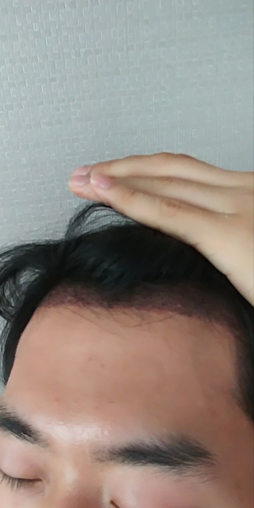 이마3.jpg