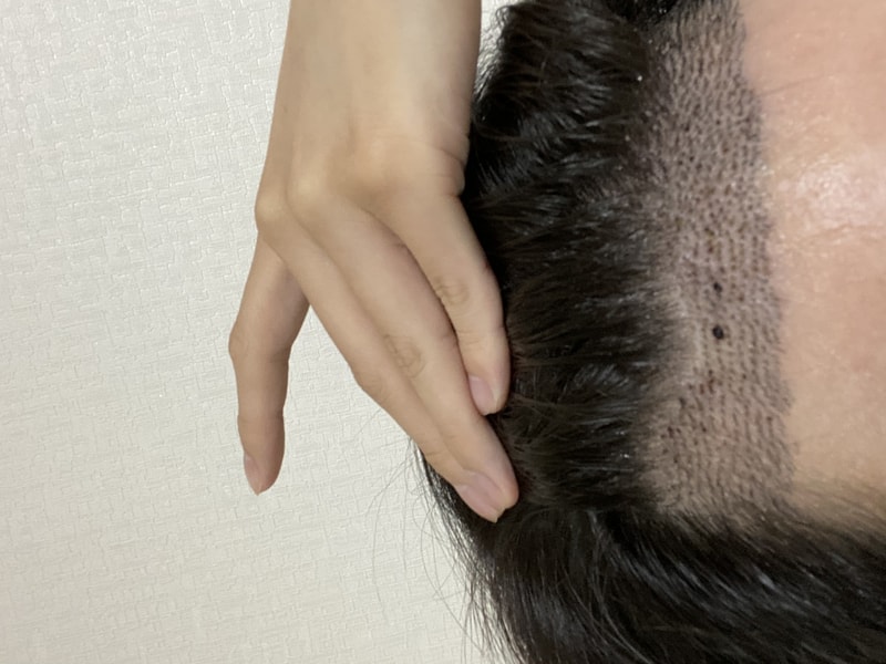 B13745D1-DF0B-40A0-A640-3C5574286241.jpeg