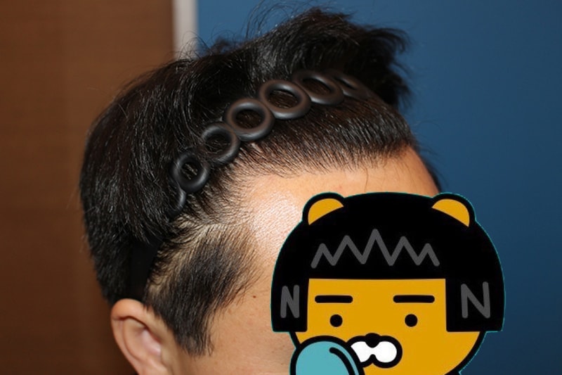 10개월 경과2.JPG
