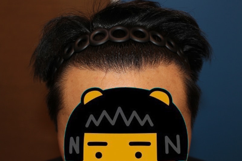 10개월 경과1.JPG