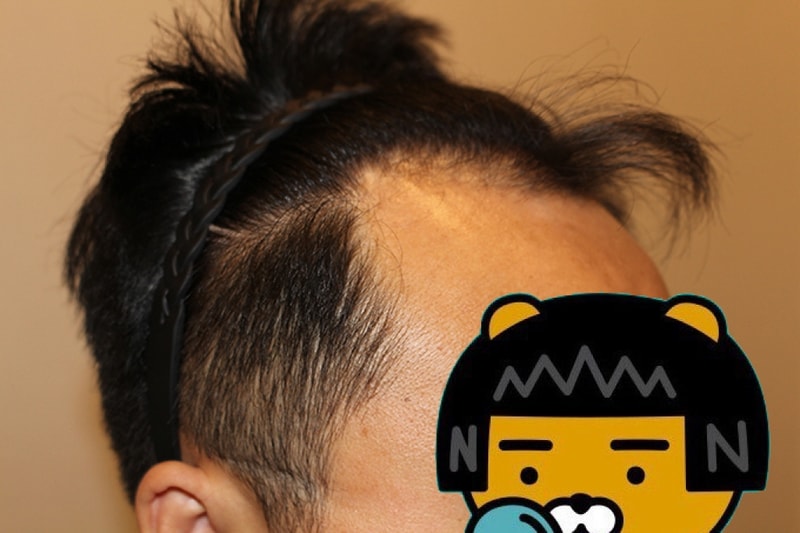 수술전2.JPG