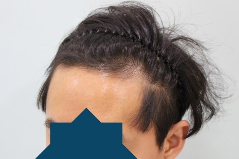 수술전5.jpg