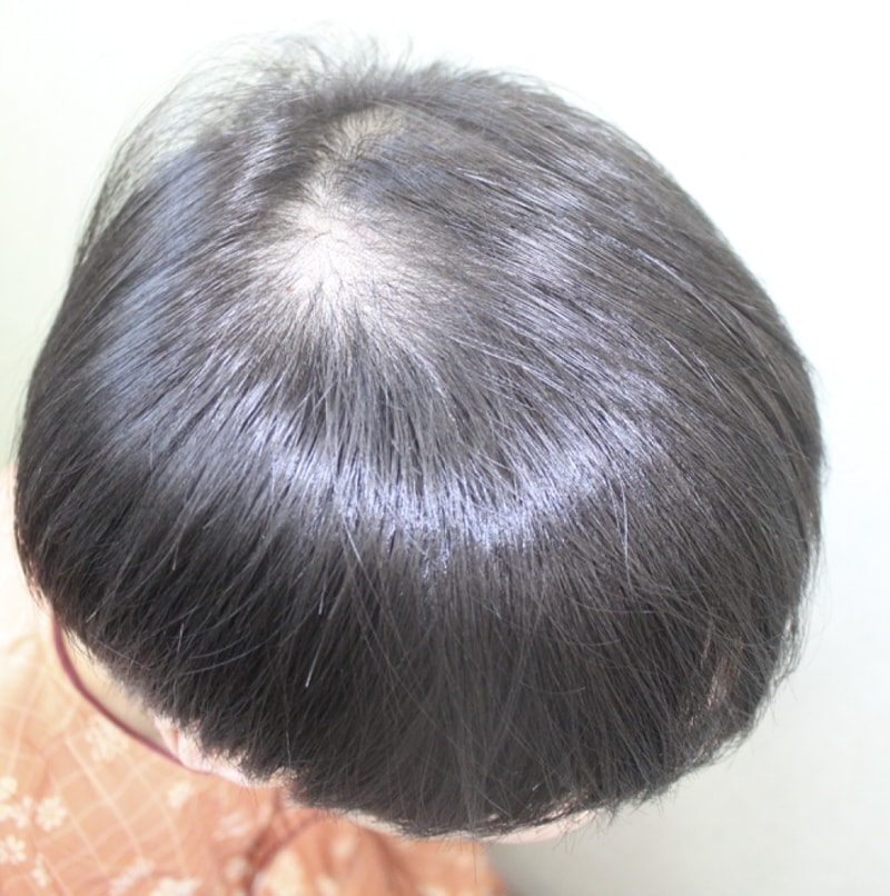 이 동식_20161215_모발_65027.png