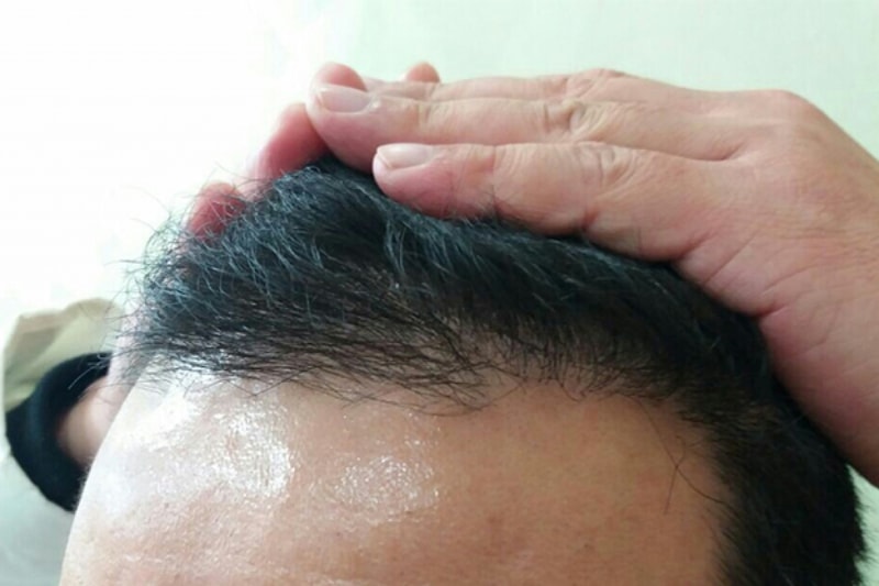 수술후1.jpg