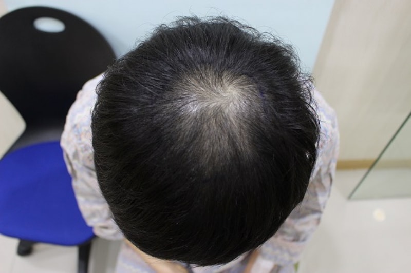 수술전 디자인 (2).JPG
