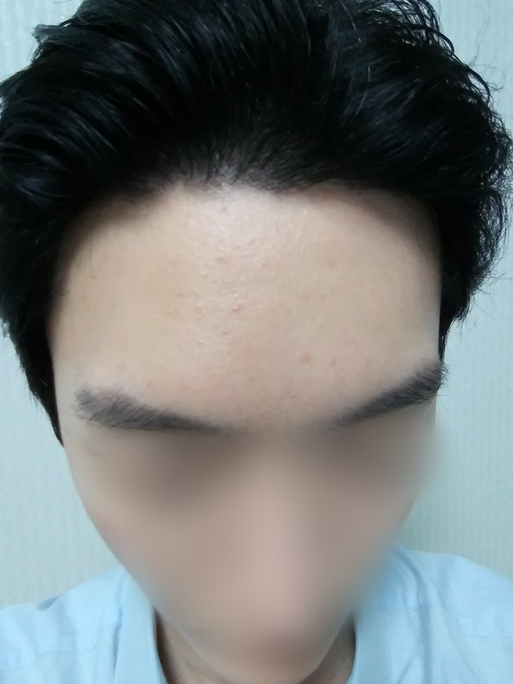 05.김재환_수술9달.jpg