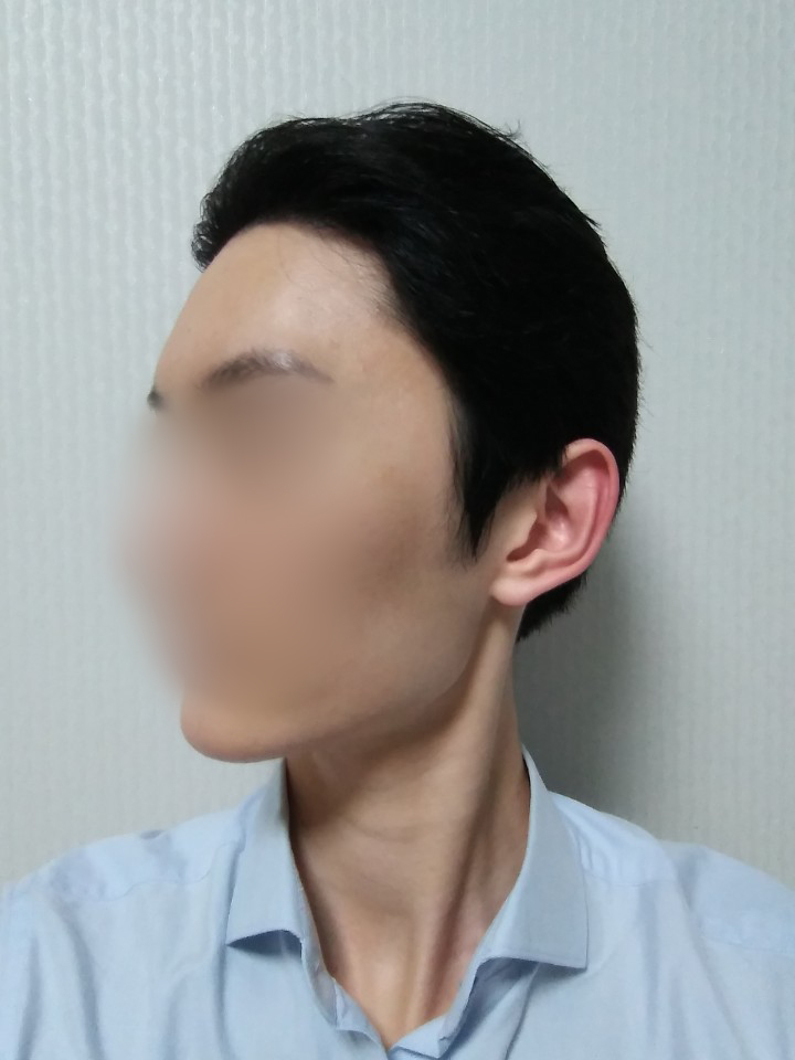 03.김재환_수술9달.jpg